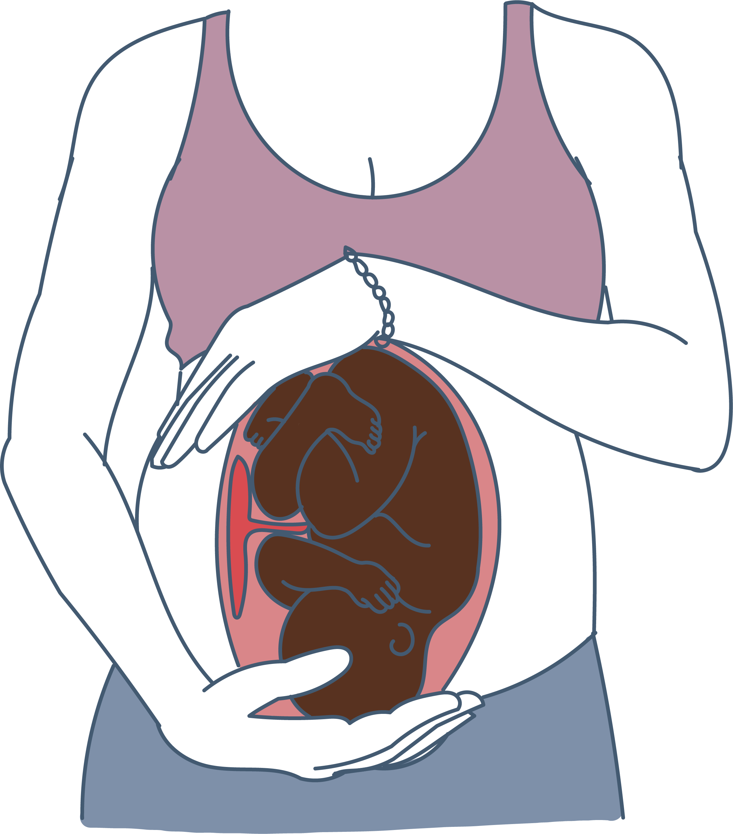 what is ceph presentation in pregnancy