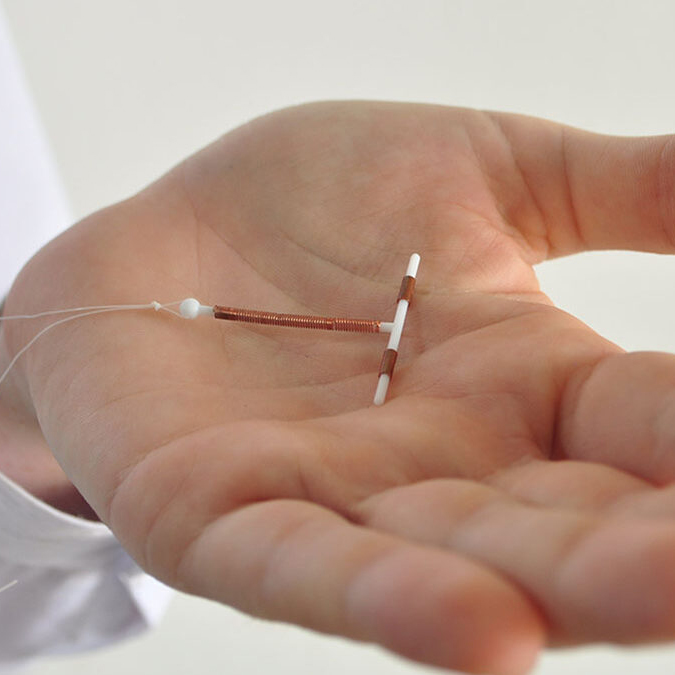 Understanding IUDs