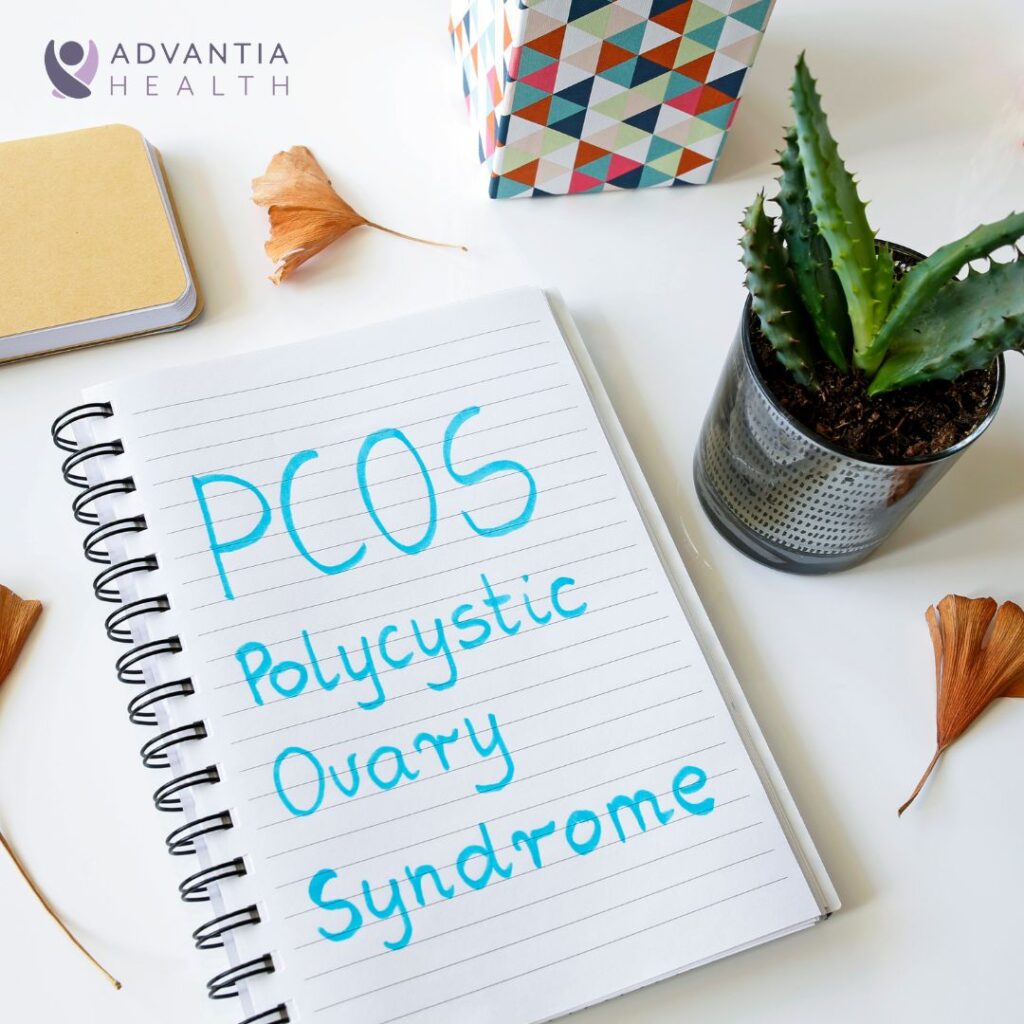 Managing PCOS: Understanding Symptoms and Treatment Options