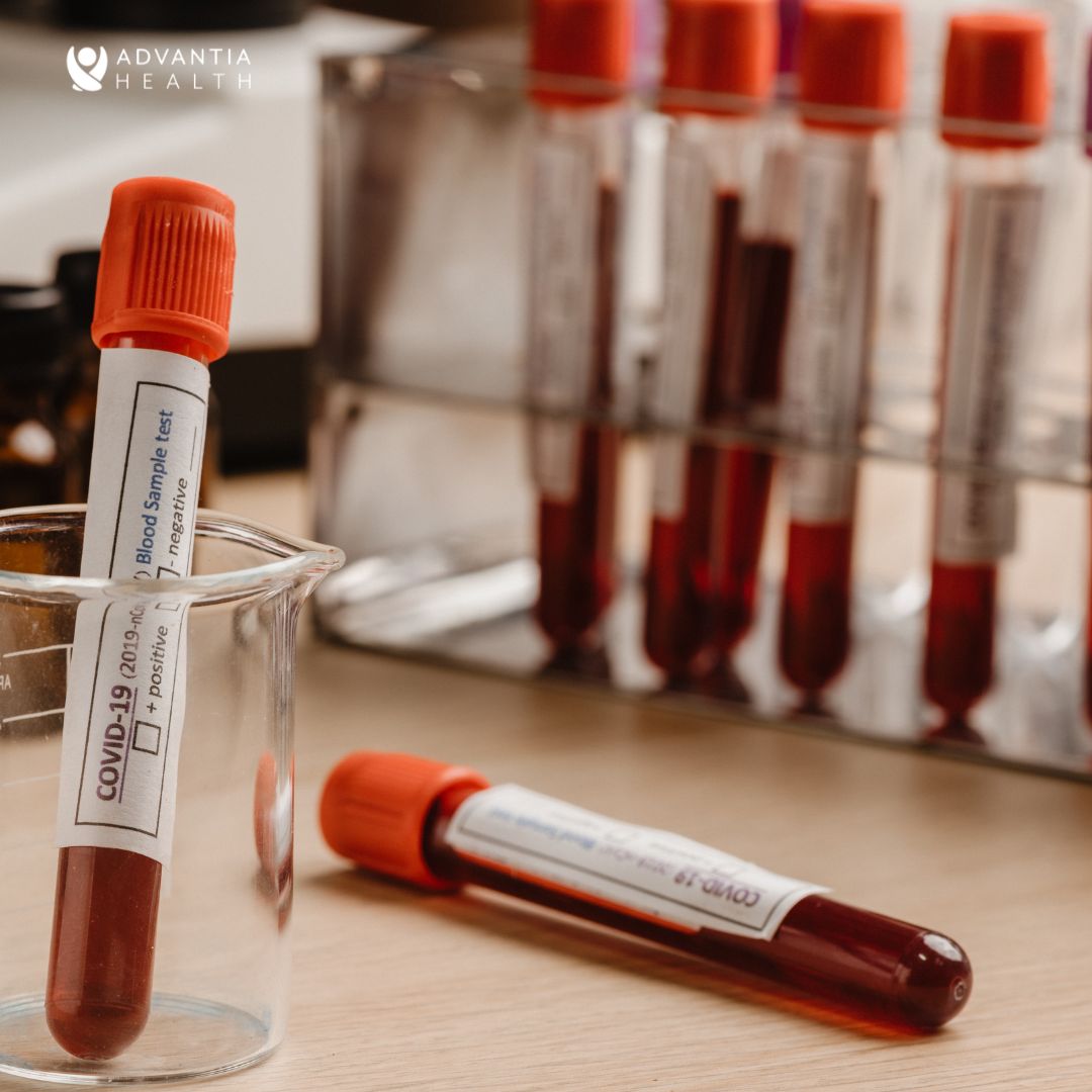 lab test 2